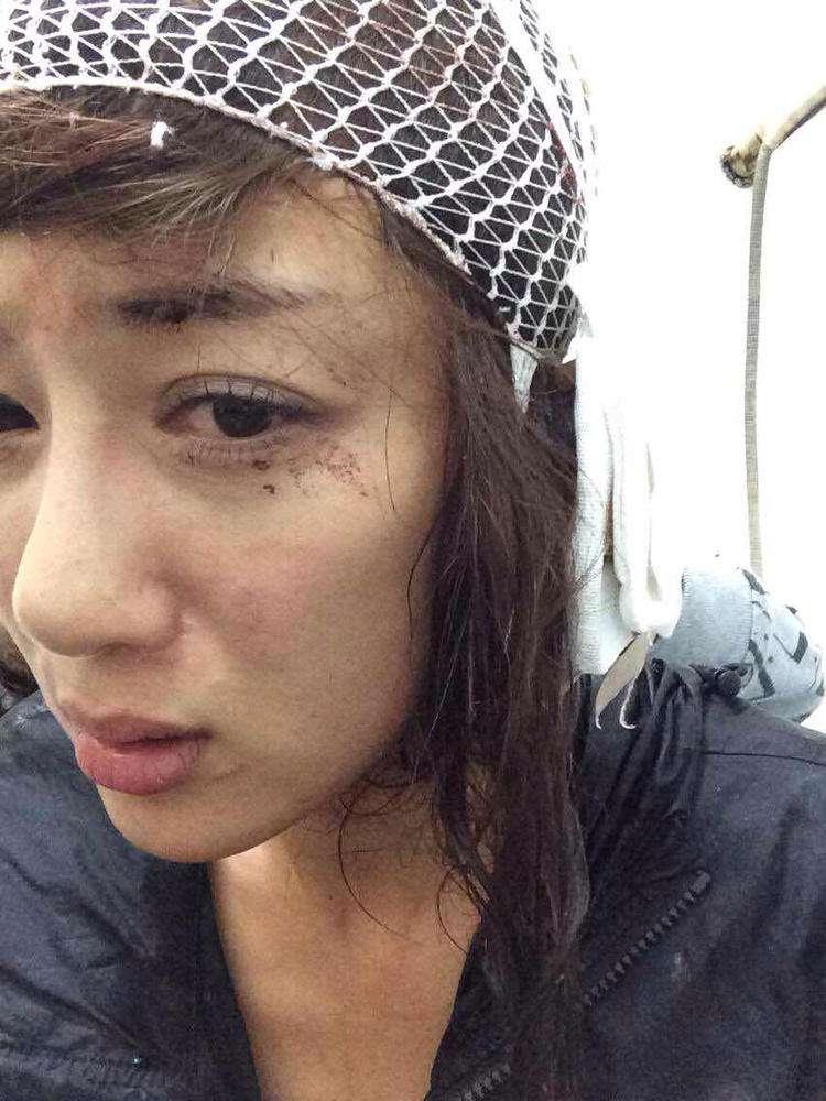 明星整容毀容最嚴(yán)重的是誰(shuí)，深度探討與反思，深度探討與反思，哪位明星整容遭遇最慘重的毀容？