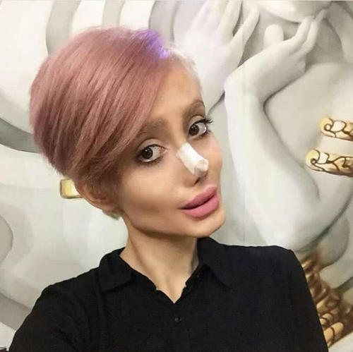 整容最瘋狂的女人，背后的故事與心理探索，整容狂熱背后的女人故事與心理揭秘