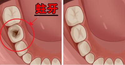 智齒，口腔健康的關(guān)鍵要素與智齒SEO的重要性，智齒，口腔健康的關(guān)鍵與SEO優(yōu)化的重要性