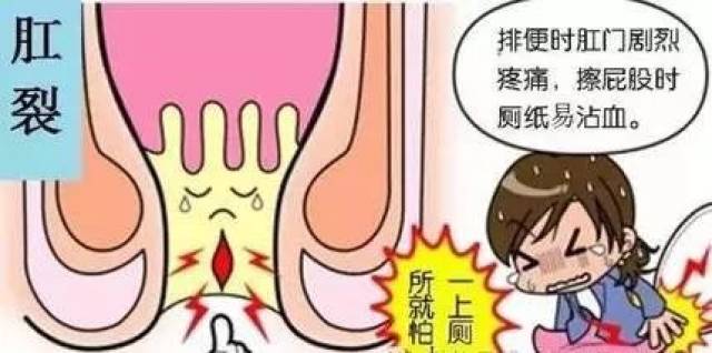 肛裂怎么快速愈合，藥物治療與護理建議，肛裂快速愈合方法，藥物治療與護理建議攻略