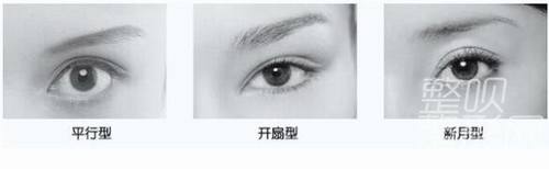 平扇與開扇雙眼皮，哪種更適合你？哪個更好看？，雙眼皮手術(shù)，平扇與開扇風(fēng)格的選擇與美觀度探討