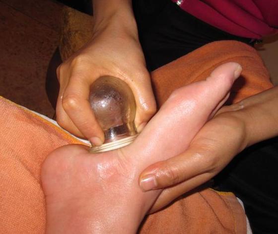 拔火罐對腎虛有好處嗎？深度解析傳統(tǒng)療法與現(xiàn)代健康理念，拔火罐對腎虛的益處解析，傳統(tǒng)療法與現(xiàn)代健康理念融合探索