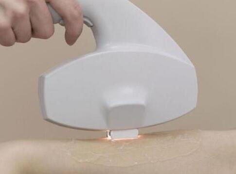 激光脫毛一次大概需要多少錢？詳解費(fèi)用因素與個(gè)人化差異，激光脫毛費(fèi)用詳解，價(jià)格因素與個(gè)人化差異探究