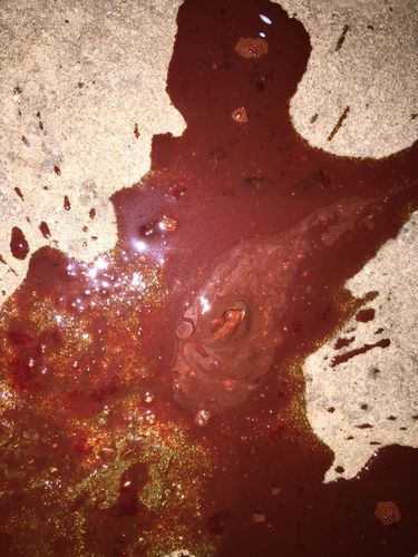 男性拉血是怎么回事？解讀便血現(xiàn)象及其原因，男性便血現(xiàn)象解析，原因及應(yīng)對方法