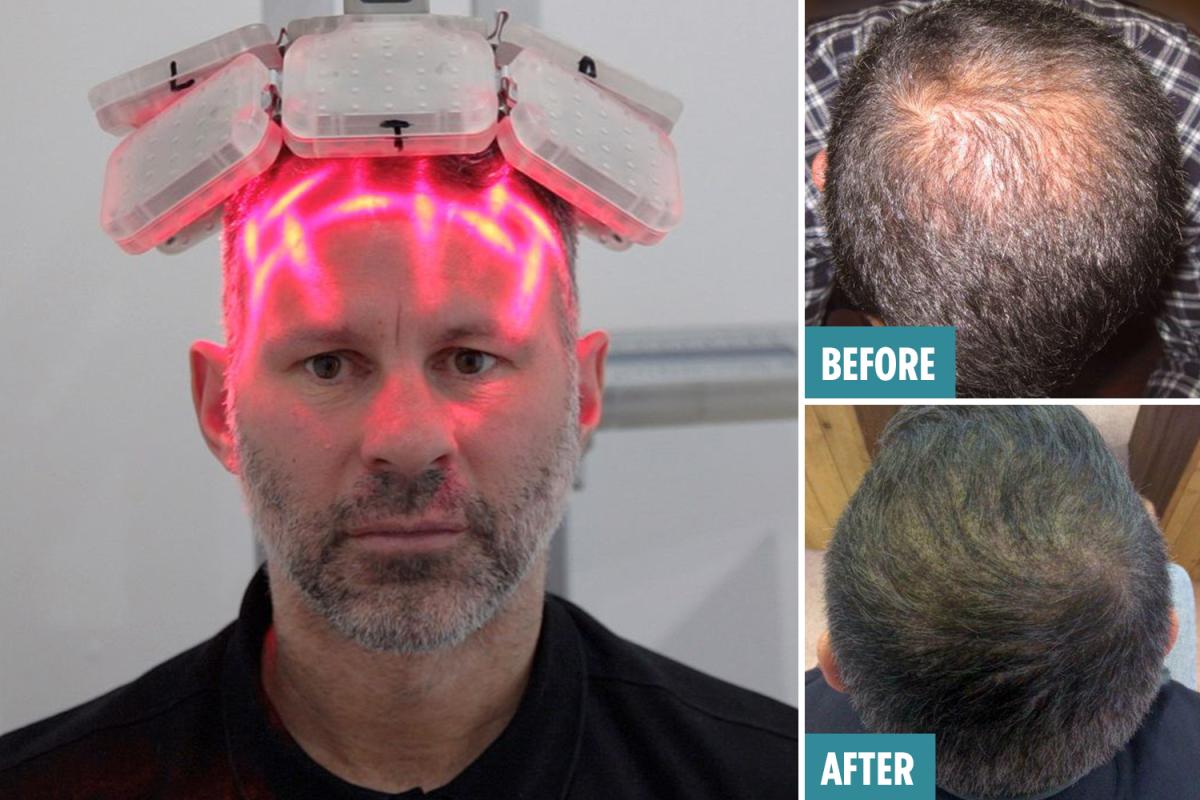 激光手術(shù)費(fèi)用詳解，多少錢一次？，激光手術(shù)費(fèi)用全面解析，手術(shù)費(fèi)用究竟是多少？