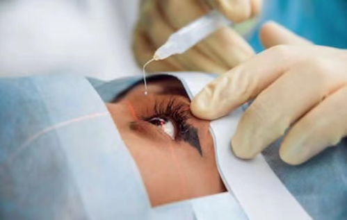 做近視眼手術(shù)的危害，全面解析與深度探討，全面解析與深度探討，近視眼手術(shù)的危害及風(fēng)險(xiǎn)分析