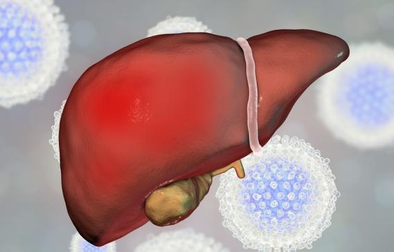 肝硬化的癥狀及表現(xiàn)，肝硬化的癥狀與表現(xiàn)概述