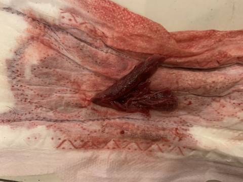 月經(jīng)排出爛肉是好事嗎？解讀月經(jīng)中的異物及其背后的健康信號，月經(jīng)排出爛肉現(xiàn)象解析，月經(jīng)中的異物與健康信號探討