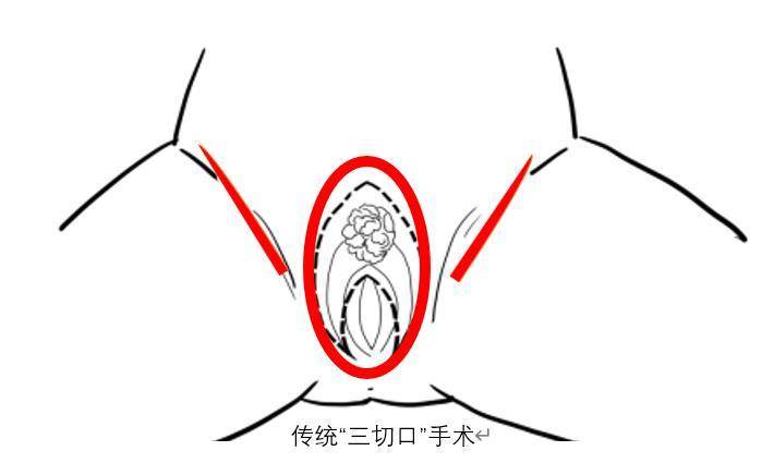 正常陰脣圖片，了解、識別與重要性，正常陰脣圖片，了解、識別及其重要性