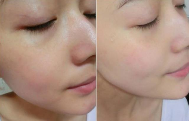 如何解決臉上出油太多的問(wèn)題，解決臉部出油過(guò)多的方法技巧
