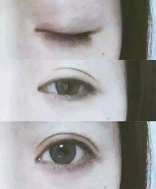 如何自然形成雙眼皮——天然方法解析，自然形成雙眼皮的秘訣，天然方法全解析