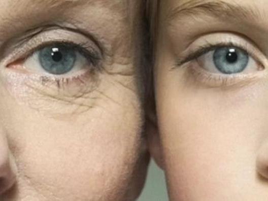 眼紋去除最佳方法，全面解析有效策略，眼紋去除秘訣大揭秘，全面解析最佳方法與有效策略