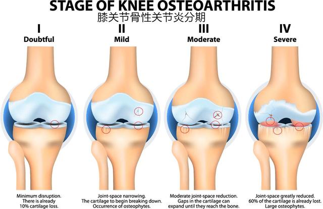 膝關(guān)節(jié)疼痛的十大原因及其應(yīng)對(duì)方法，膝關(guān)節(jié)疼痛的成因與應(yīng)對(duì)方法解析，十大常見原因及應(yīng)對(duì)策略