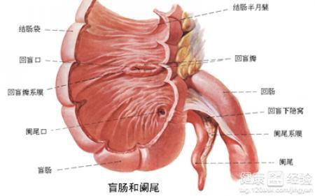 闌尾炎疼痛部位解析，闌尾炎疼痛部位詳解