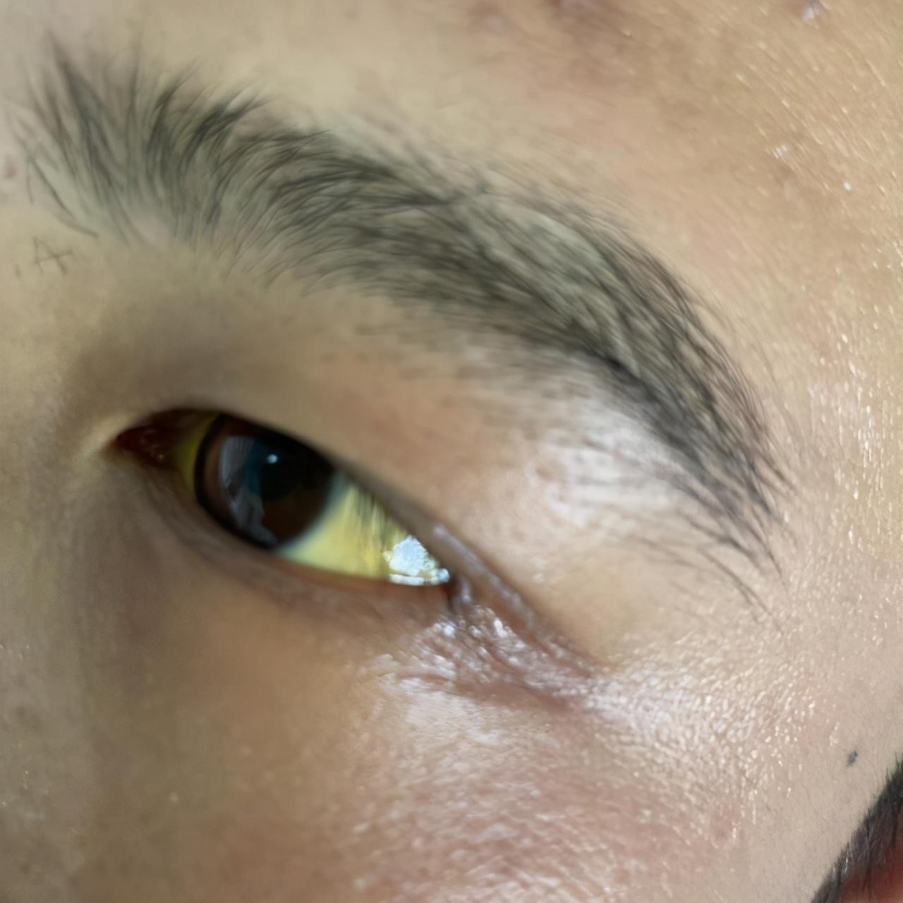 肝功能正常值參考表及其重要性，肝功能正常值參考表，揭示肝臟健康的關(guān)鍵指標(biāo)及其重要性