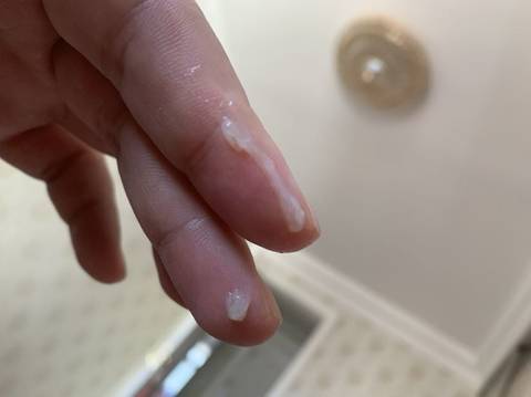 關(guān)于性行為后白帶增多的原因解析，性行為后白帶增多原因解析，揭秘背后的健康隱患