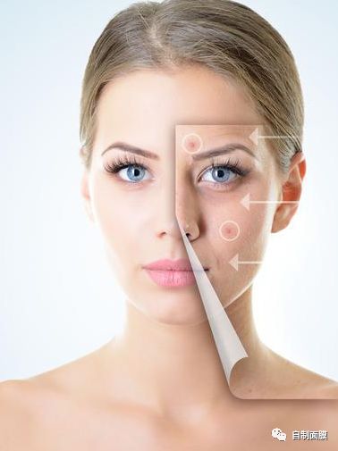 痘坑怎么去除最有效的方法，全面解析痘坑修復之道，全面解析，痘坑修復的最有效方法，痘坑去除指南