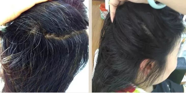 白發(fā)轉(zhuǎn)黑發(fā)，可能性與實(shí)現(xiàn)方法，白發(fā)轉(zhuǎn)黑發(fā)的可能性與實(shí)現(xiàn)方法探討