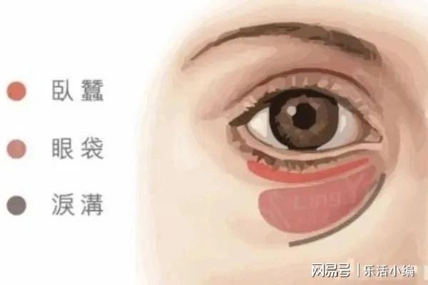 眼袋切除手術(shù)費用詳解，價格因素與如何選擇合適的手術(shù)方案，眼袋切除手術(shù)費用解析，了解價格因素與選擇最佳手術(shù)方案