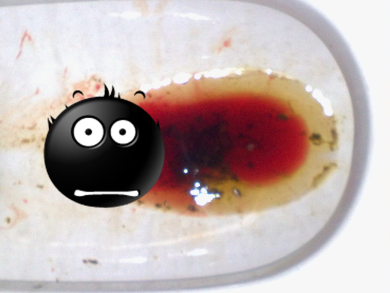 拉屎出血但不疼，原因分析及應對措施，拉屎出血但不疼，原因解析與應對策略