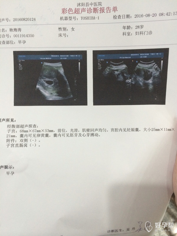 懷孕多少天可以查出來，全面解析早期妊娠檢測方式，懷孕多少天可以檢測出來？早期妊娠檢測方式的全面解析