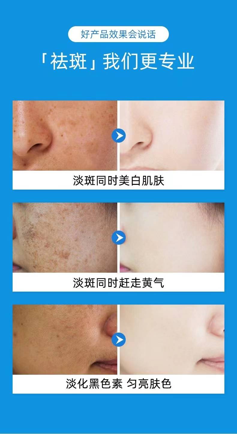 揭秘祛斑最佳方法，如何達(dá)到最佳祛斑效果？，揭秘最佳祛斑方法，實(shí)現(xiàn)最佳效果的秘訣！