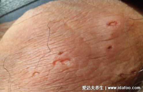 得性疾病前兆，了解、預(yù)防與應(yīng)對，得性疾病的早期信號，了解、預(yù)防與應(yīng)對策略