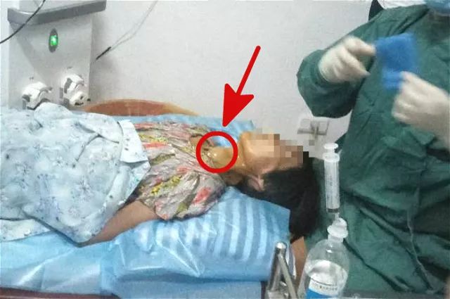 甲狀腺結(jié)節(jié)4A持續(xù)二十年，深入了解與管理，甲狀腺結(jié)節(jié)二十年持續(xù)觀察與管理策略