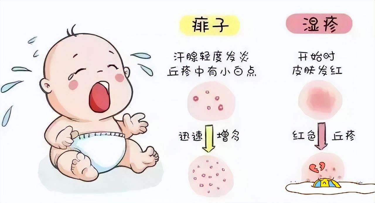 痱子和濕疹的區(qū)別，深入了解兩種常見皮膚狀況，痱子和濕疹的區(qū)別，常見皮膚狀況詳解