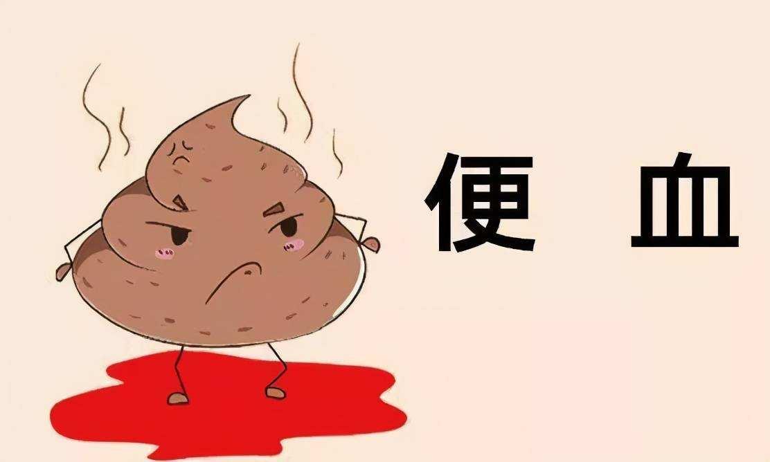 大便噴血滴鮮血無痛感，揭示潛在的健康問題，大便無痛性出血，揭示潛在健康問題的警示信號(hào)
