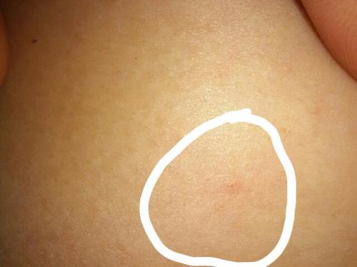 乳房一碰就疼，原因、診斷與治療方法，乳房疼痛，原因解析、診斷方法及治療策略