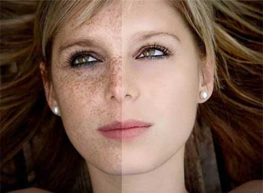 去除臉上的斑小妙招，實用方法與日常護(hù)理建議，實用小妙招，祛斑美白，日常護(hù)理臉部斑點的方法