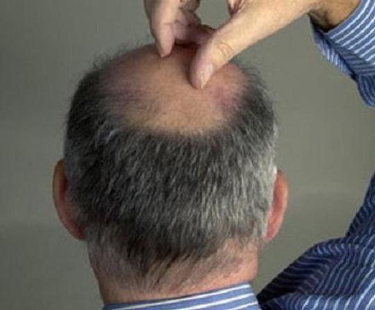 男人氣血不足腎虛的調(diào)理方法與日常保健，男人氣血不足腎虛調(diào)理方法與日常保健指南