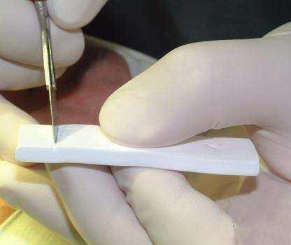 關(guān)于隆鼻材料的選擇，哪種材料最好最安全？，關(guān)于隆鼻材料的選擇，哪種材料最安全且效果最好？