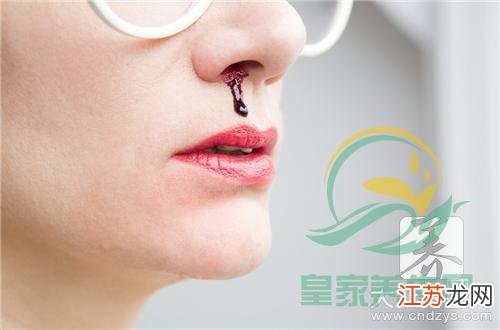 流鼻血最怕三種水果，了解并預(yù)防鼻部出血的飲食禁忌，流鼻血飲食禁忌，三種水果需警惕，預(yù)防鼻部出血的飲食指南