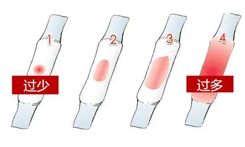 如何分辨撤退性出血和月經(jīng)，如何區(qū)分撤退性出血與月經(jīng)？